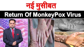 18 साल बाद फिर जिंदा हो गया ‘MonkeyPox’, जानिए इस घातक वायरस के लक्षण और इलाज
