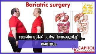 Know about 'Bariatric surgery'  |  News60 ML