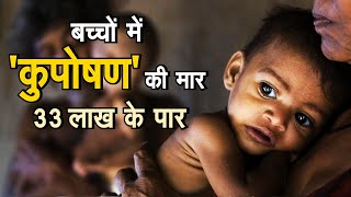 भारत में 33 लाख बच्चे कुपोषण की जकड़ में | RTI रिपोर्ट में हुआ खुलासा || Malnutrition ||
