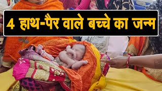 4 हाथ-पैर वाले बच्चे का हुआ जन्म, देखने के लिए जुटी भीड़, देखिए LIVE Video