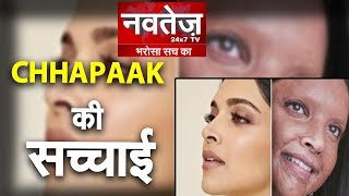 Chhapaak Movie Review : | Deepika Padukone | Vikrant Massey | Meghna Gulzar | Chhapaak Reality Check