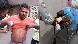Chemical Blast Ki Wajah Se labours Zakhmi | Hyderabad Jalpally | SACH NEWS |