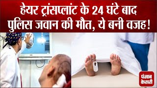 Hair Transplant कराने के बाद पुलिस जवान को सिर में हुआ दर्द, 24 घंटे बाद अस्पताल में तोड़ा दम