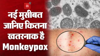 यूरोप के देशों में Monkeypox का कहर, World Health Organization ने जताई चिंता | जानिए कितना खतरनाक