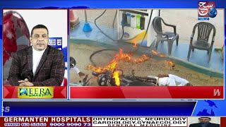 HYDERABAD NEWS EXPRESS | Petrol Daalte Waqt Bike Mein Lagi Aag | 04-07-2022 | SACH NEWS |