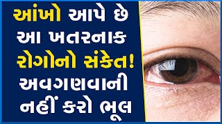 આંખો આપે છે આ ખતરનાક રોગોનો સંકેત! અવગણવાની નહીં કરો ભૂલ #Eye