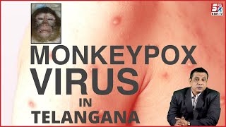 Hyderabad Ke Fever Hospital Mein Aaya Monkey Pox Ka Pehla Case | SACH NEWS |
