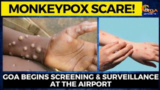 Monkeypox scare! Goa begins screening & surveillance at the airport