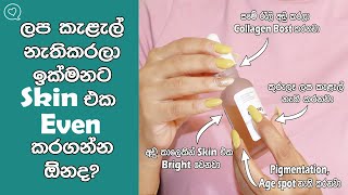 How To Get Rid Of Pigmentation | Dark spots And Uneven Skin