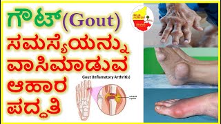 ಗೌಟ್(Gout) ಸಮಸ್ಯೆಯನ್ನು  ವಾಸಿಮಾಡುವ ಆಹಾರ ಪದ್ಧತಿ || Best Food for Gout patients || Kannada Sanjeevani
