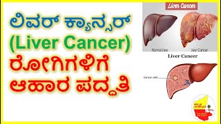 Liver Cancer ರೋಗಿಗಳಿಗೆ ಆಹಾರ ಪದ್ಧತಿ || Best food for Liver Cancer Patients || Kannada Sanjeevani