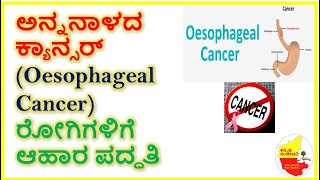 ಅನ್ನನಾಳದ ಕ್ಯಾನ್ಸರ್ (Oesophageal Cancer )ರೋಗಿಗಳಿಗೆ ಆಹಾರ ಪದ್ಧತಿ || Kannada Sanjeevani