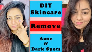My DIY Skin Care Routine | Tips to avoid pimple and dark spots | JSuper Kaur