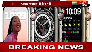 Apple Watch भी सेफ नहीं, यूजर ने किया बैटरी फटने का दावा