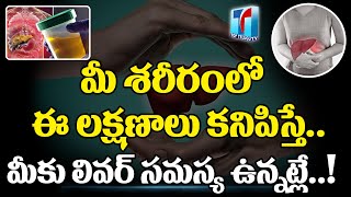 Symptoms of Liver Diseases |Early singns of Liver Damage |Early Liver Disease Symptoms|Top Telugu TV