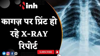 Gwalior में Health Systems ही फ्रैक्चर ! X-Rays फिल्म नहीं तो कागज पर दे रहे Print | Latest News
