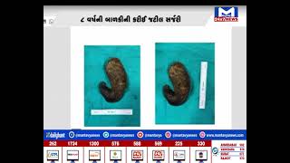 Ahmedabad : સિવિલ હોસ્પિટલમાં 8 વર્ષની બાળકીની કરાઈ જટિલ સર્જરી  | MantavyaNews