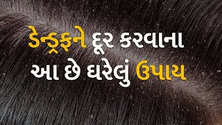 ડેન્ડ્રફને દૂર કરવાના આ છે ઘરેલું ઉપાય #hair #hairstyle #dandruff