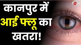 Eye Flu: कानपुर देहात में आई फ्लू का खतरा!, डॉक्टर्स सावधानी बरतने की कर रहे अपील || Khabar Fast ||