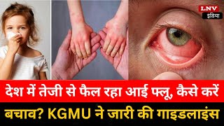 Eye Flu: देश में तेजी से फैल रहा आई फ्लू, कैसे करें बचाव? KGMU ने जारी की गाइडलाइंस