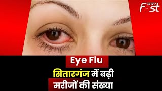 Eye Flu: देशभर में बढ़ रहे आई फ्लू, सितारगंज में मरीजों की संख्या में बढ़ोतरी || Khabar Fast