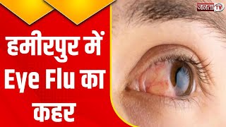Hamirpur में Eye Flu का प्रकोप, एक दिन में 222 मामले आए सामने, जिला स्वास्थ्य विभाग हुआ अलर्ट