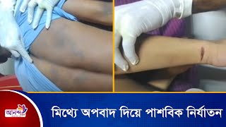 টাকা চুরির মিথ্যে অপবাদ দিয়ে দোকান মালিক ইয়াসিন ও তার ভাই ইয়াকুবের পাশবিক নির্যাতন