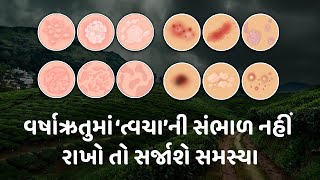 વર્ષાઋતુમાં ‘ત્વચા’ની સંભાળ નહીં રાખો તો સર્જાશે સમસ્યા