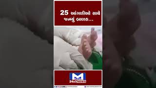 25 આંગળીઓ સાથે જન્મ્યું બાળક... | MantavyaNews