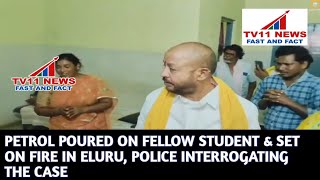 PETROL POURED ON FELLOW STUDENT & SET ON FIRE IN ELURU, POLICE INTERROGATING THE CASE