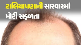 ટાલિયાપણાની સારવારમાં મોટી સફળતા #Health #HealthTips #Alopecia #Hairloss #Hair