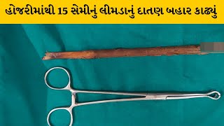 Sabarkantha : વૃદ્ધના પેટમાંથી 15 સેમીનું દાતણ નીકળ્યું| MantavyaNews