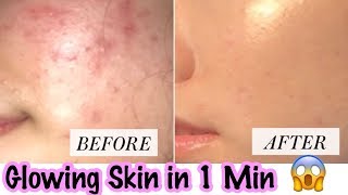 Glowing Clear Skin in 1 min ! Remedy for Open Pores, Pimples, Dark Spots | JSuper Kaur