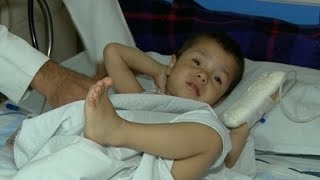 भारत में डॉक्टरों ने अफगानी बच्चे को दी नई जिंदगी, माता-पिता बेहद खुश