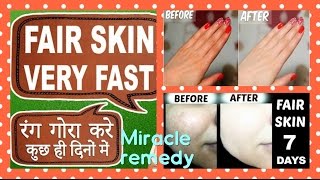 Skin WHITENING MAGICAL remedy (RESULTS in LIVE VIDEO) | Get FAIR skin at HOME in 1 week | 100% WORKS