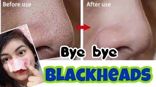 Remove Blackheads/Whiteheads Naturally - Demo | JSuper Kaur