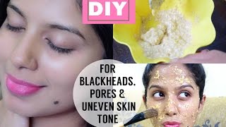 DIY Scrub for Blackheads, Uneven Skin Tone and Pores