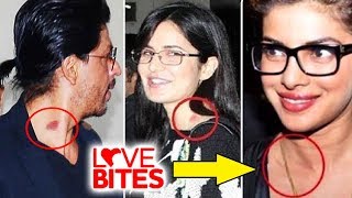 Bollywood Celebs Caught With LOVE BITES - Shahrukh Khan, Katrina Kaif, Priyanka Chopra