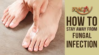 How To Stay Away From Fungal Infection | Dr. Shehla Aggarwal