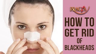 How To Get Rid Of Blackheads | Payal Sinha