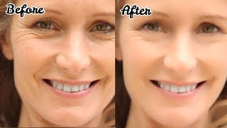 How to Remove Wrinkles - झुर्रियों से छुटकारा - Anti Ageing Night Cream DIY | JSuper Kaur