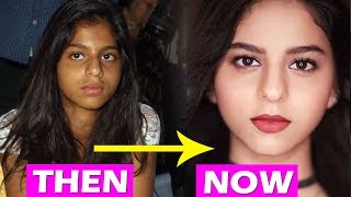 Shahrukh's Daughter Suhana SHOCKING Transformation Before And After