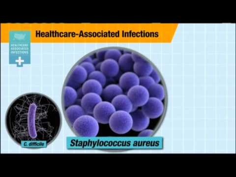 CDC- One in 25 Hospital Patients Has Infection News Video
