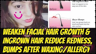 Home Remedy for Ingrown Hair, Pimples, Redness after Waxing | Weaken Facial Hair Growth Naturally