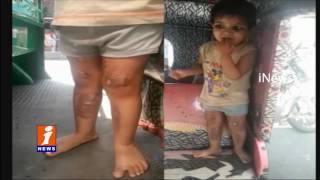 2 Years Baby Girl Punished Very cruelly by Arrogant Mother Due to Family Clashes| Vijayawada | Inews